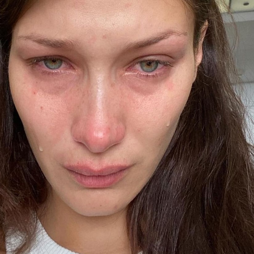 Crying Bella Hadid Opens Up About Anxiety Struggles: 'Pretty Much My Everyday'